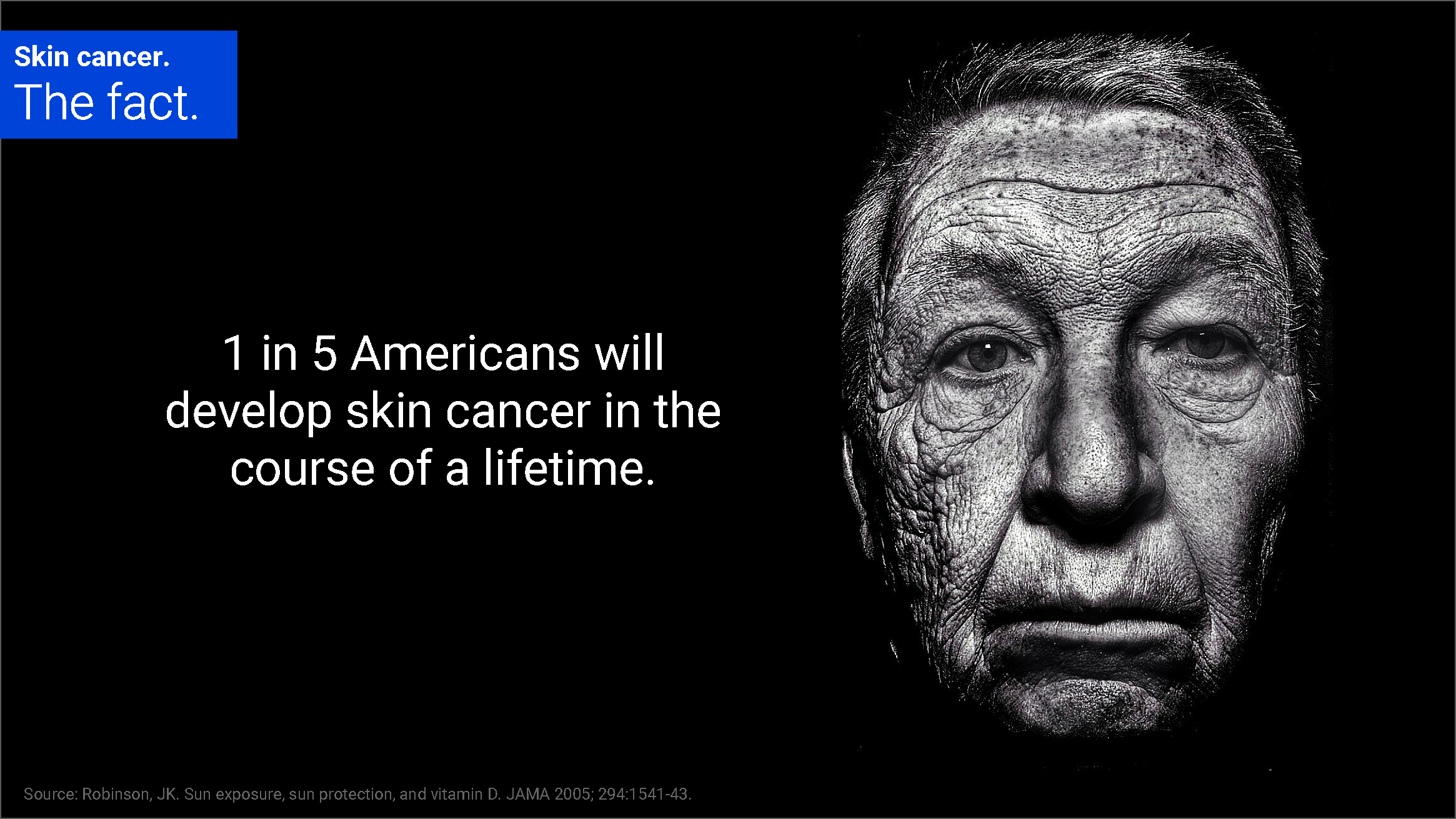 Skin cancer fact statistic